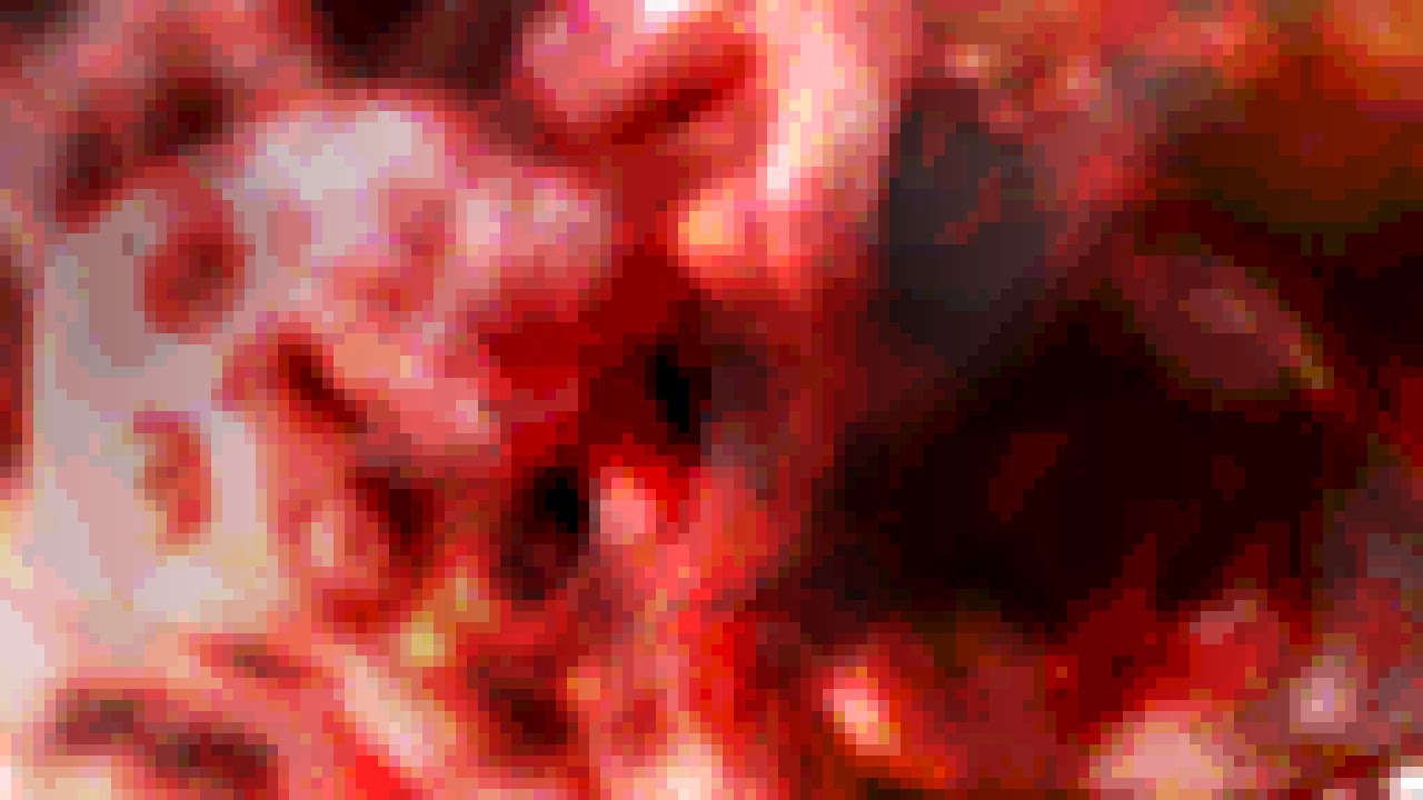 Video thumbnail Video thumbnail